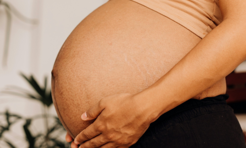 maternidad